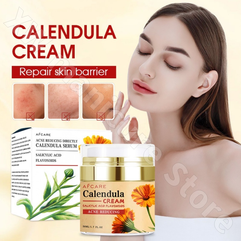 Memperbaiki Calendula Krim Pel - Skincare Luxury Whitening ulasan dan harga