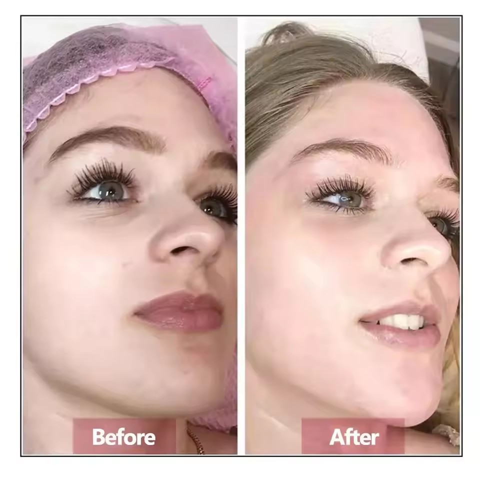Serum Anti-Kerut Mewah Black R - Luxury Skincare Serum ulasan dan harga